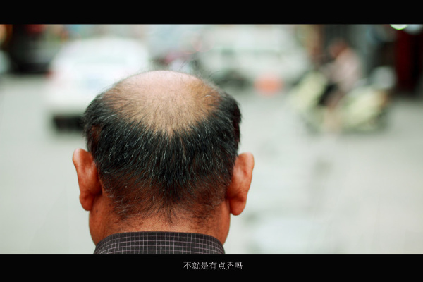 不就是有点秃吗