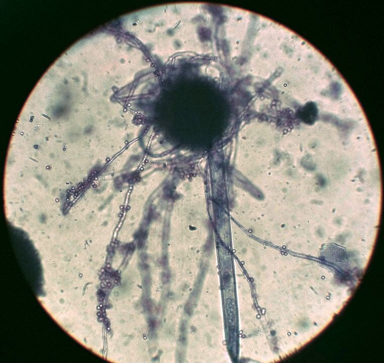 霉菌镜下图片图片